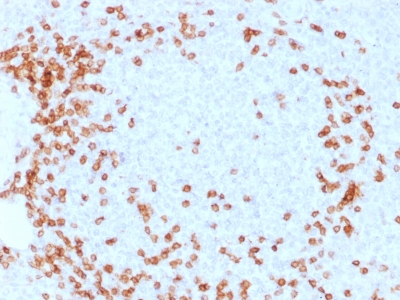 FFPE human spleen sections stained with 100 ul anti-CD3 (clone C3e/1931) at 1:50. HIER epitope retrieval prior to staining was performed in 10mM Citrate, pH 6.0.